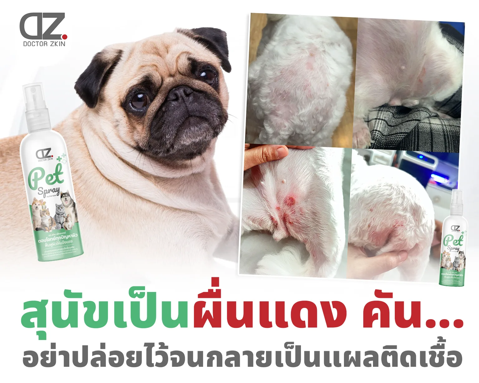 Red, itchy rashes? Don’t let them turn into infections.